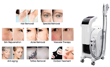 IPL Beauty Machine: The Ultimate Solution for Perfect Skin